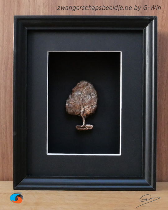 Placenta Art